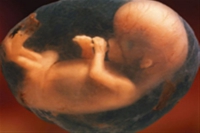 علل زنانه و مردانه هر دو می‌توانند باعث بروز سقط مکرر شوند