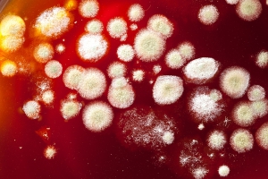 عفونت‌های قارچی، یکی از شایع‌ترین عفونتها در زنان